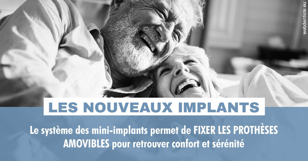 https://dr-benjamin-lascar.chirurgiens-dentistes.fr/Les nouveaux implants 2