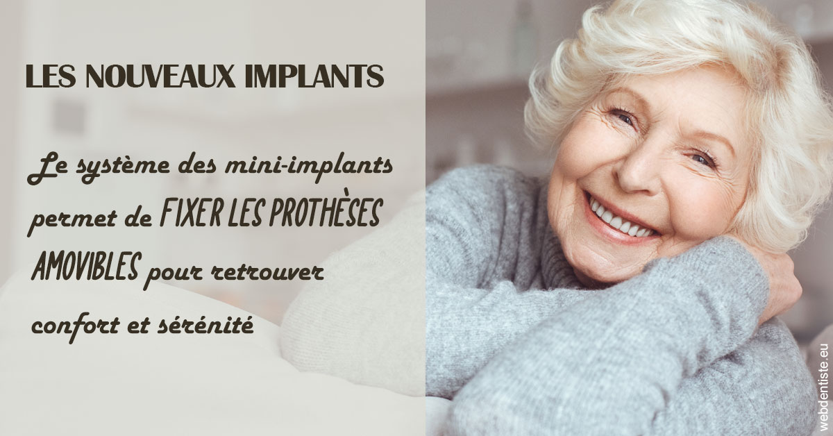 https://dr-benjamin-lascar.chirurgiens-dentistes.fr/Les nouveaux implants 1