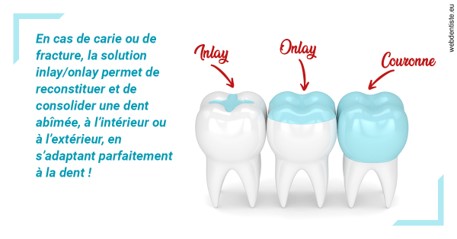 https://dr-benjamin-lascar.chirurgiens-dentistes.fr/L'INLAY ou l'ONLAY