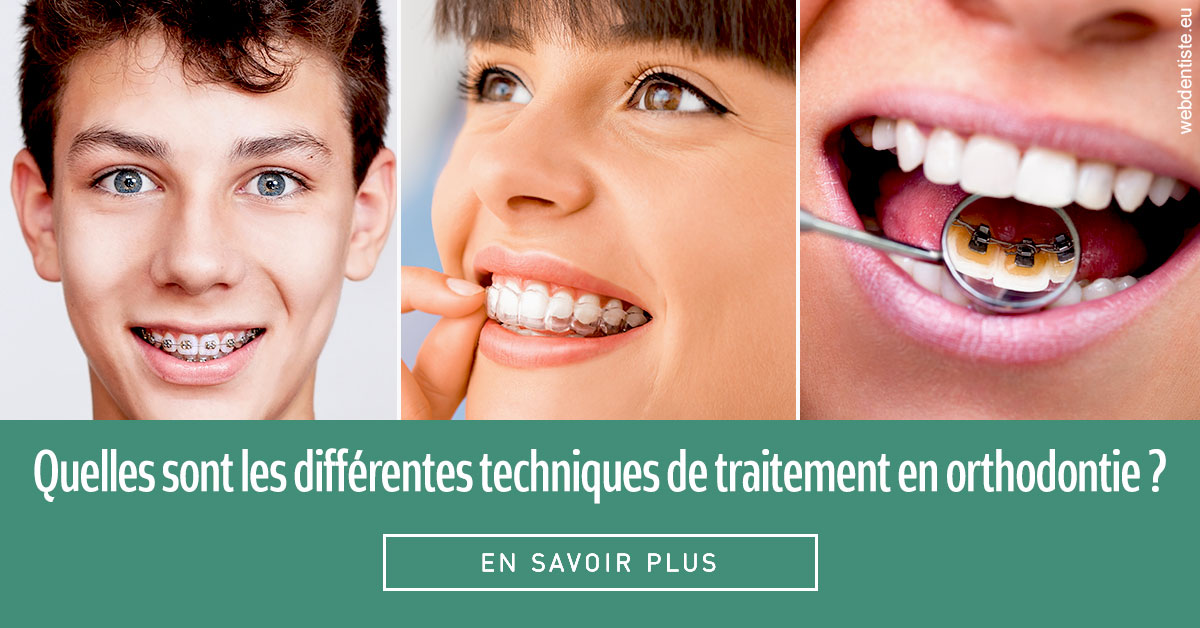 https://dr-benjamin-lascar.chirurgiens-dentistes.fr/Les différentes techniques de traitement 2
