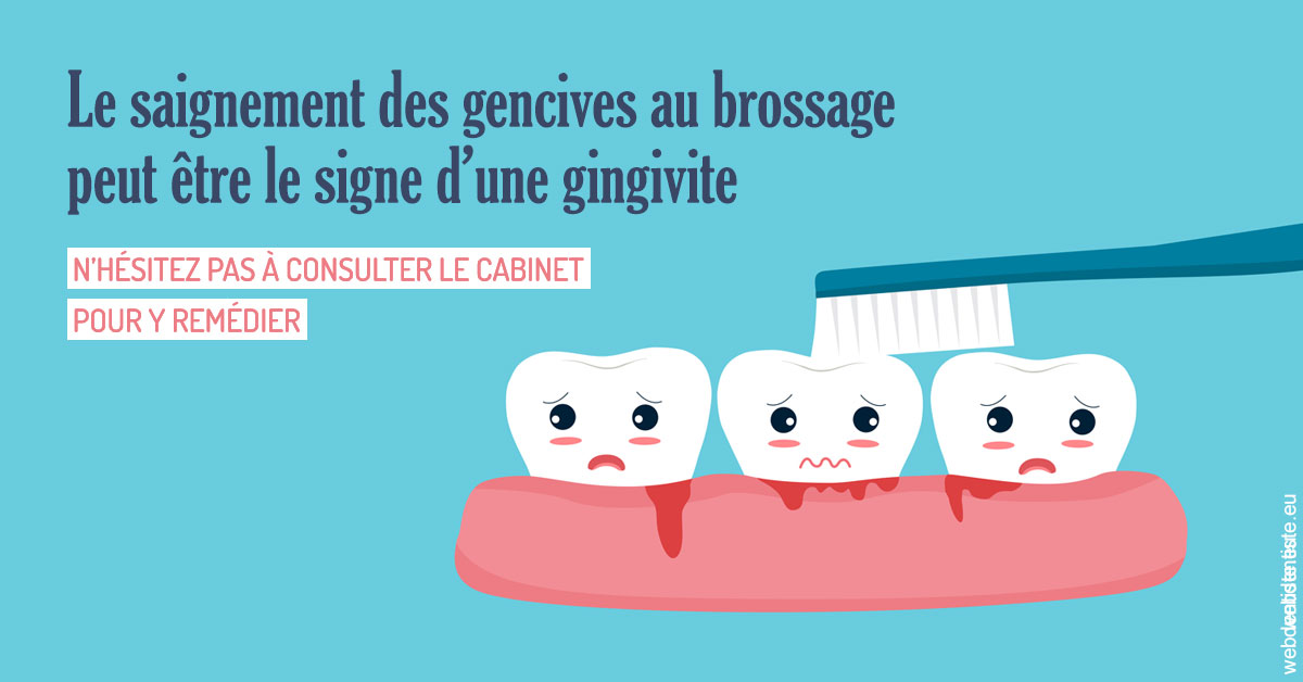 https://dr-benjamin-lascar.chirurgiens-dentistes.fr/Saignement gencives 2
