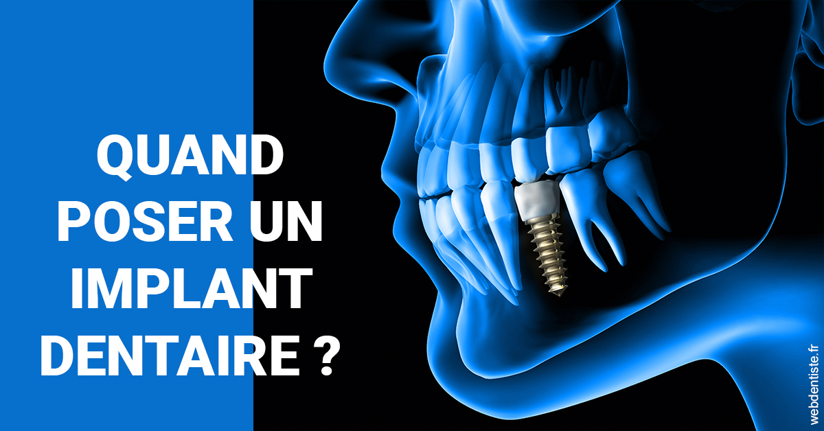 https://dr-benjamin-lascar.chirurgiens-dentistes.fr/Les implants 1
