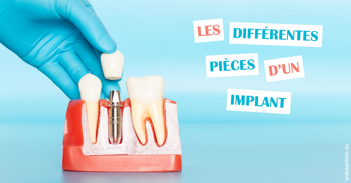https://dr-benjamin-lascar.chirurgiens-dentistes.fr/Les différentes pièces d’un implant 2