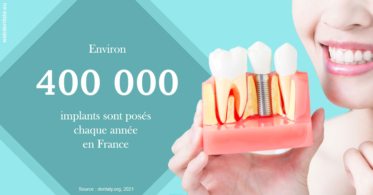 https://dr-benjamin-lascar.chirurgiens-dentistes.fr/Pose d'implants en France 2