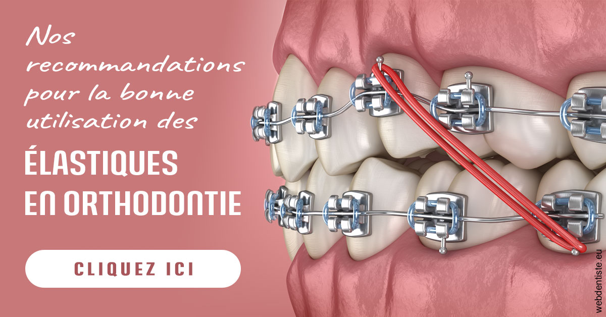 https://dr-benjamin-lascar.chirurgiens-dentistes.fr/Elastiques orthodontie 2
